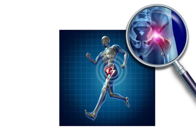 Péng wann Dir am Hip Joint leeft