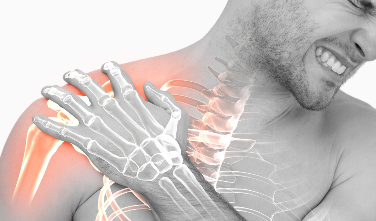 Schëller Schmerz wéinst Arthrosis